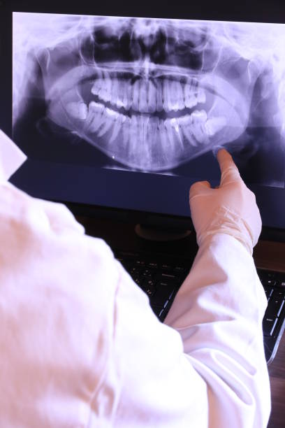 Best Emergency Dental Care for Broken or Chipped Teeth in Carlyss, LA